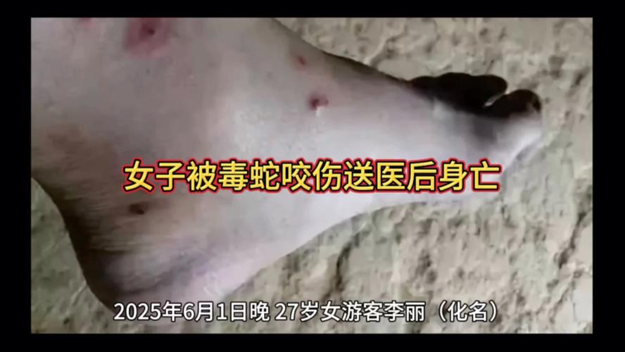 新澳门彩最快开奖记录和女子遭毒蛇咬伤身亡与女子遭毒蛇咬伤身亡视频